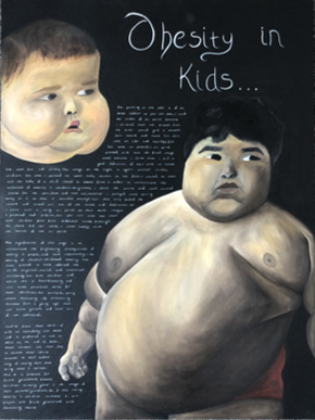 RachelP Child obesity III